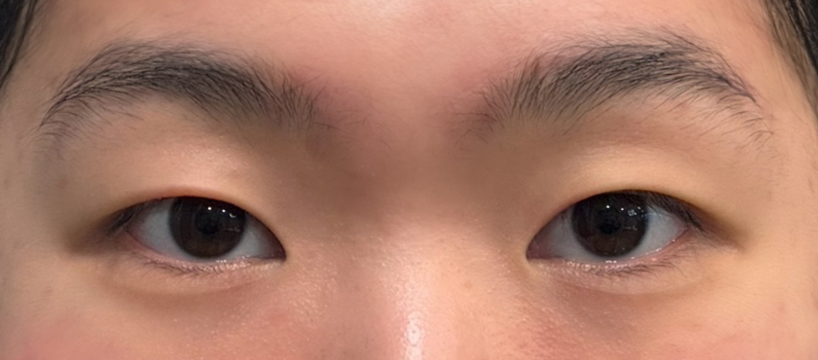VA Plastic Surgery before photo 1