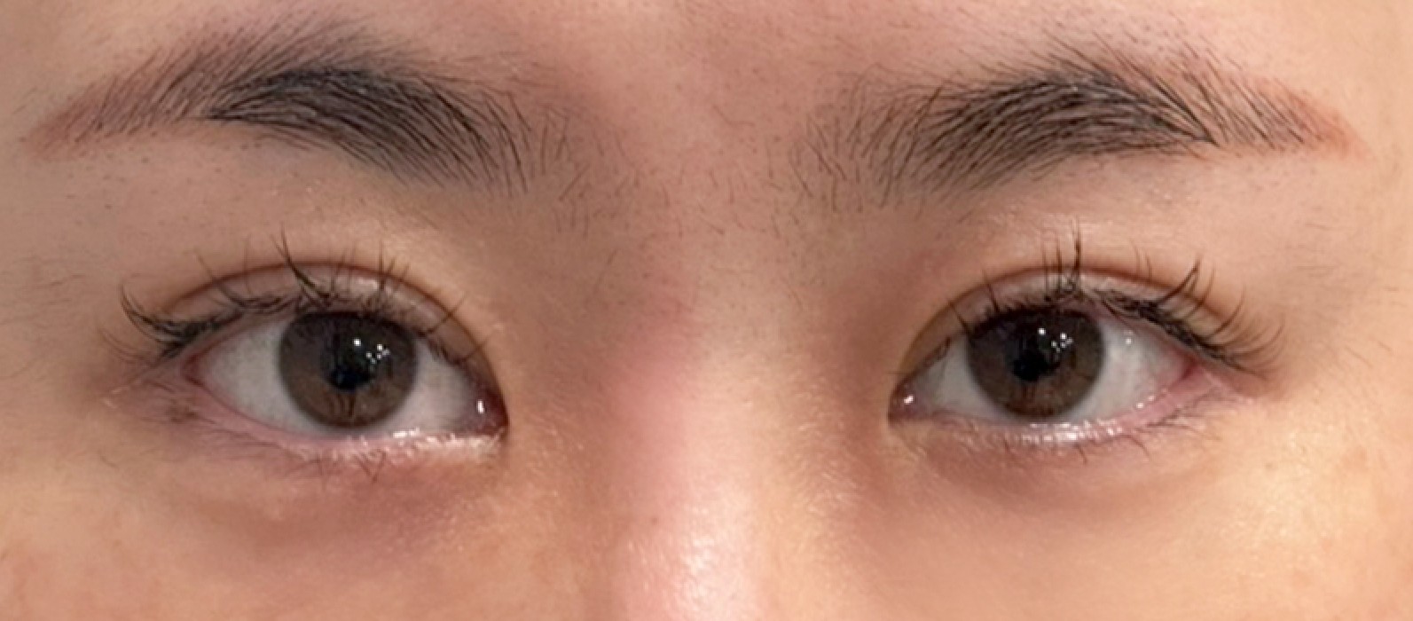 VA Plastic Surgery before photo 2