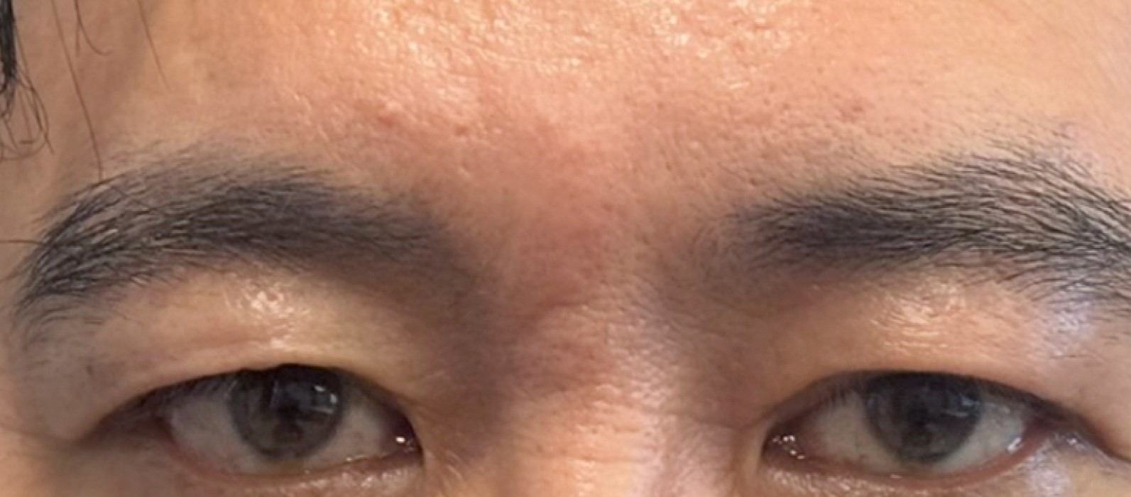 VA Plastic Surgery after photo 3