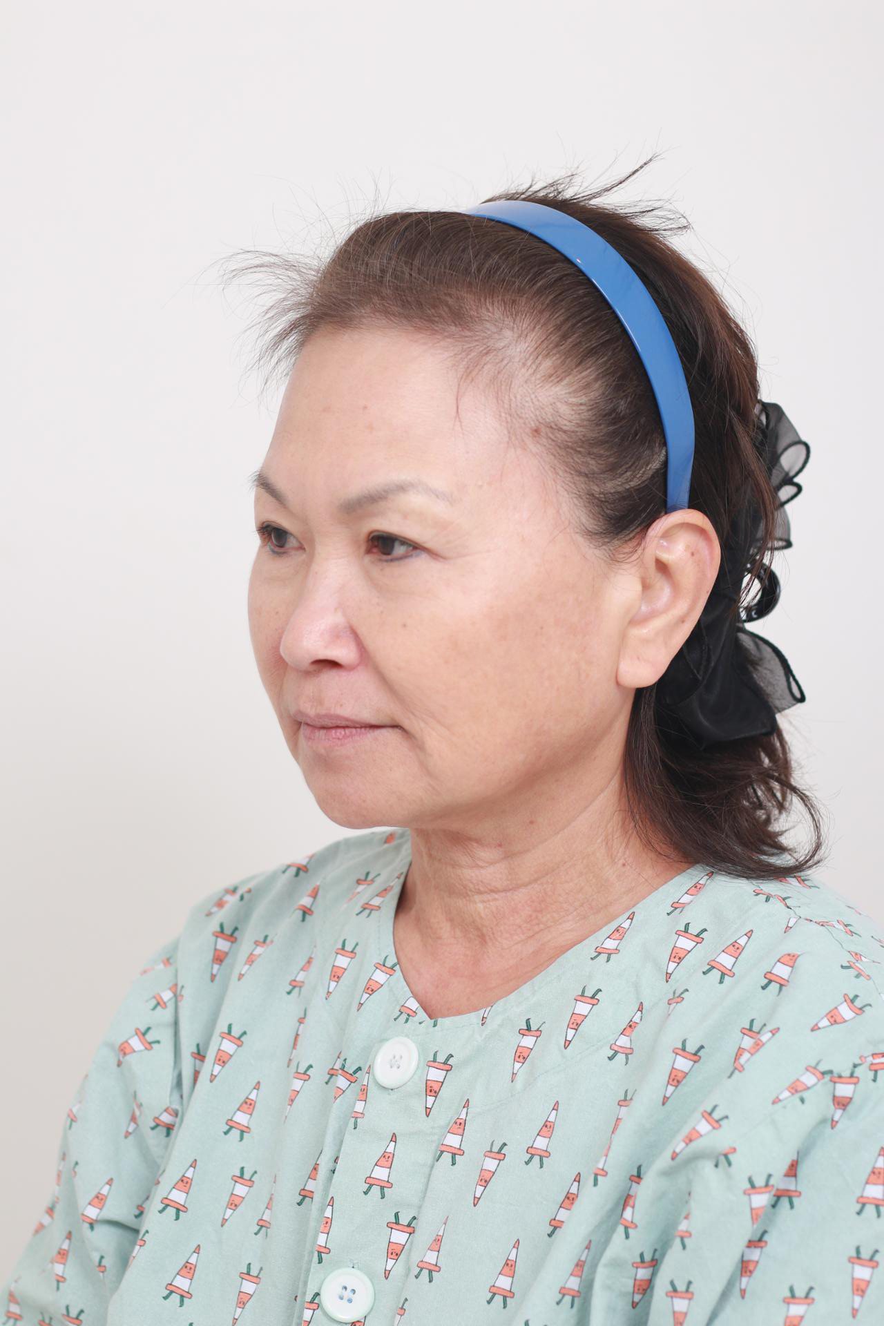 Synergy Plastic Surgery before photo 4