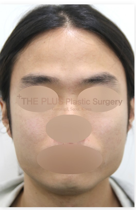 The Plus Plastic Surgery before photo 3