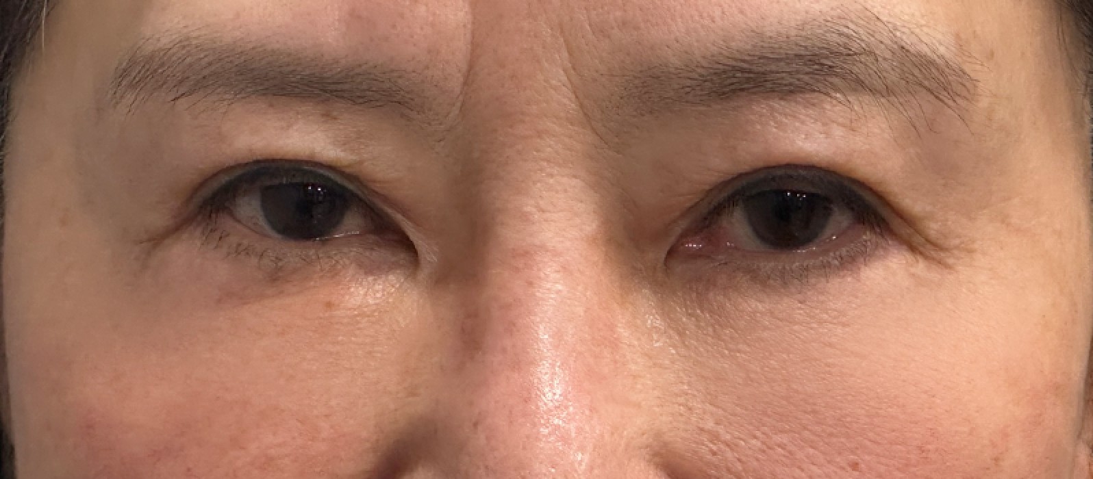 VA Plastic Surgery after photo 4