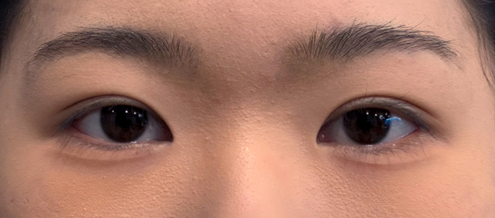 VA Plastic Surgery after photo 1