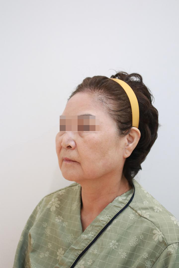Synergy Plastic Surgery before photo 3
