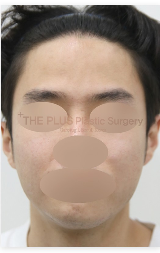 The Plus Plastic Surgery after photo 3