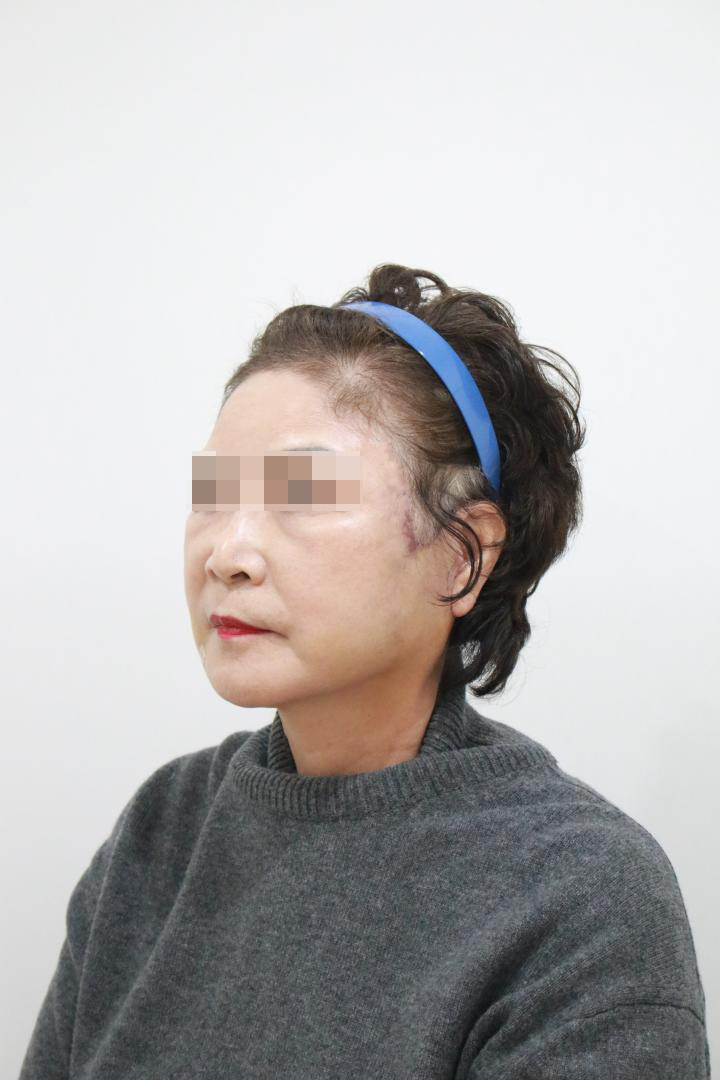 Synergy Plastic Surgery after photo 3