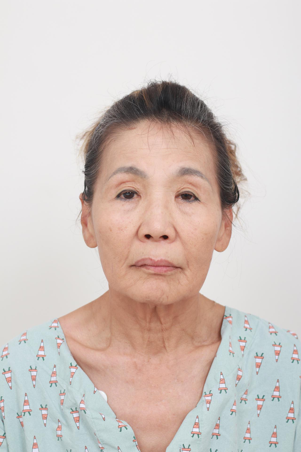 Synergy Plastic Surgery before photo 1