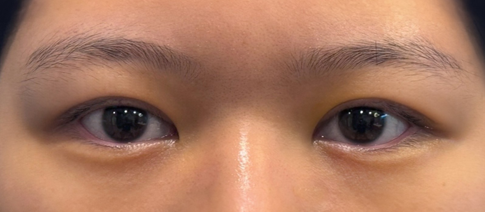 VA Plastic Surgery after photo 5