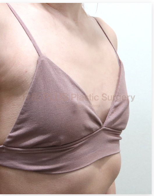 The Plus Plastic Surgery before photo 2