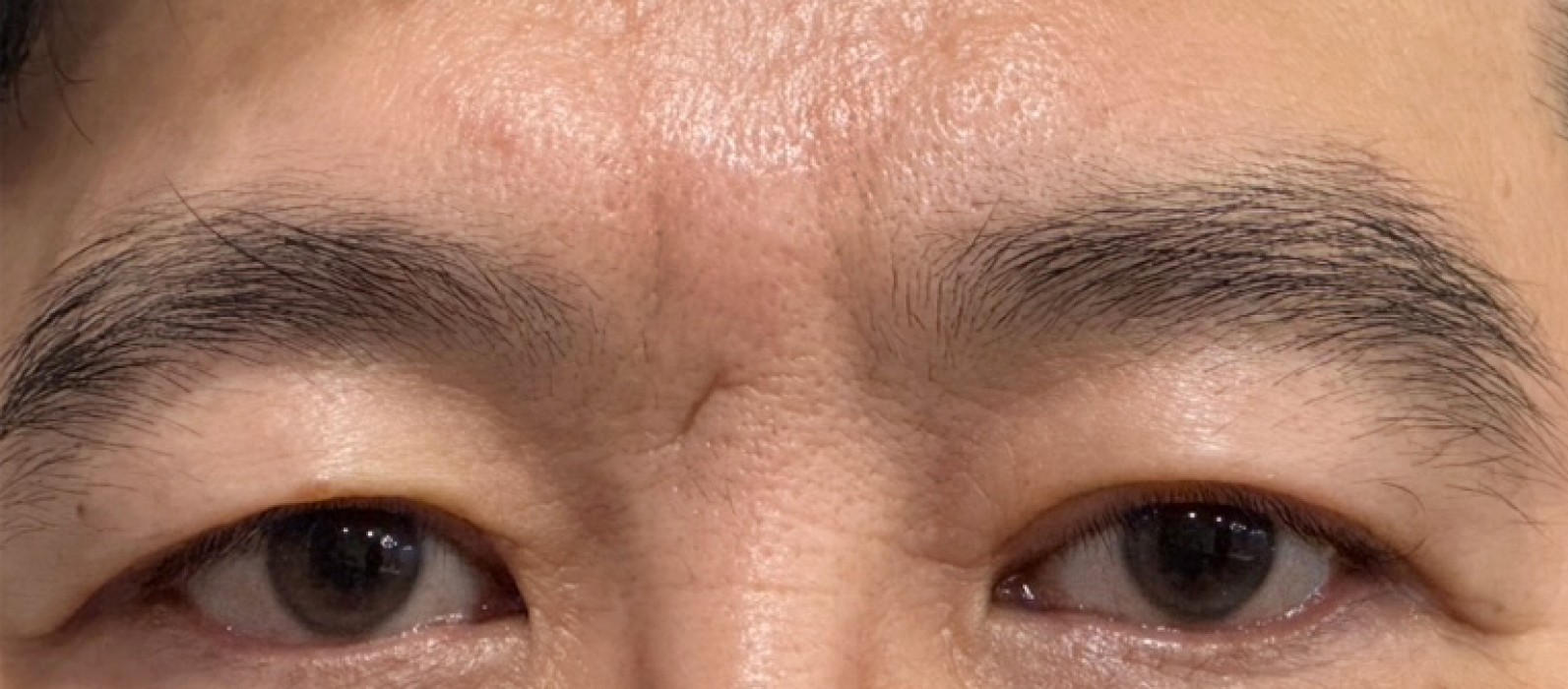 VA Plastic Surgery before photo 3